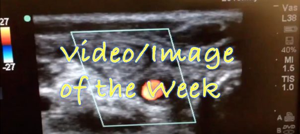 video:image clot